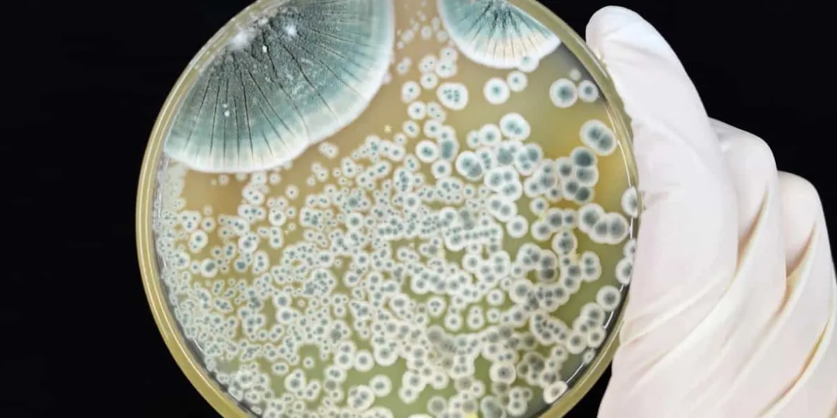 Mold-and-Bacteria